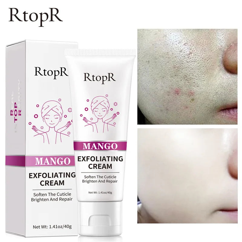 Crème Exfoliante Visage Mangue – Nettoyante et Éclaircissante